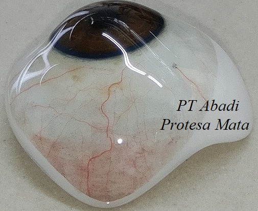 sklera abadi protesa mata, mata palsu sklera abadi protesa mata, mata palsu